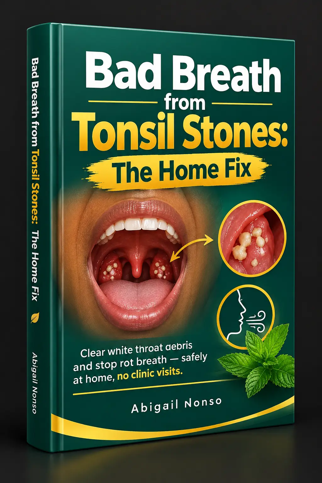 Bad Breath from Tonsil Stones: The Home Fix — PDF guide mockup